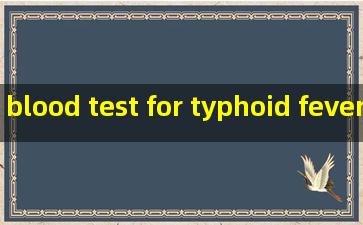 blood test for typhoid fever manufacturers